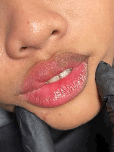 Lip Neutralization